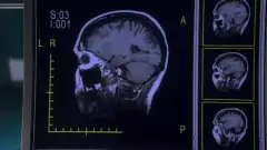 Доктор Хаус 3 сезон 22 серия